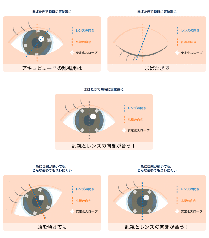乱視軸度の向きを瞬時に合わせる