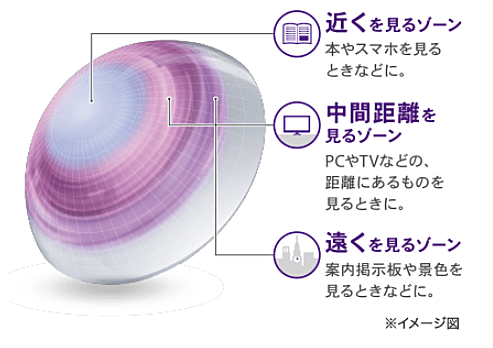 アルコン独自のマルチフォーカルデザイン