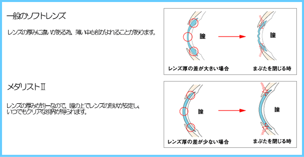 メダリストⅡのユニバランスデザイン