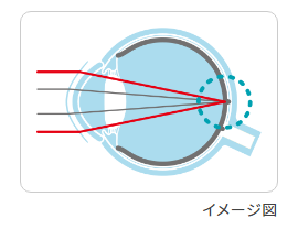 非球面光学設計