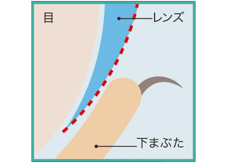 ワンデーアキュビューモイストマルチフォーカルのレンズエッジデザイン