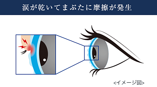 まぶたの摩擦