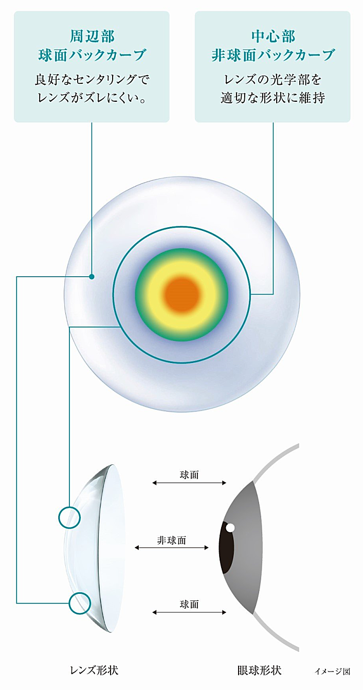 アキュビューオアシスマルチフォーカルのレンズデザイン