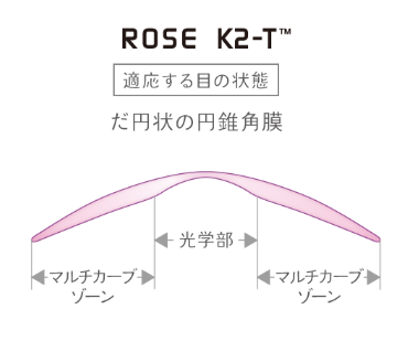 ローズＫ-Ｔのデザイン