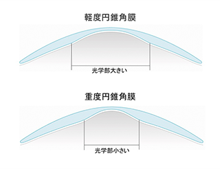 ローズＫ2のデザイン