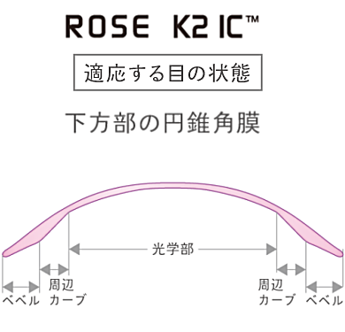 メニコンローズK2 IC