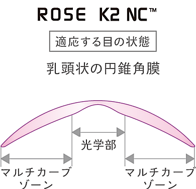 ローズK2NCのデザイン